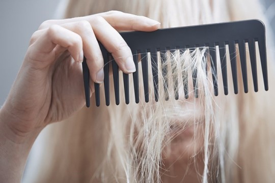 برای تشخیص علت ریزش مو چه آزمایشاتی لازم است؟